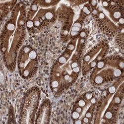 NEK8 Antibody, Novus Biologicals:Antibodies:Primary Antibodies